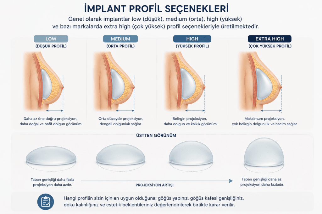Meme protezi profil seçenekleri: düşük (low), orta (medium), yüksek (high) ve ekstra yüksek (extra high) implant profilleri karşılaştırması.