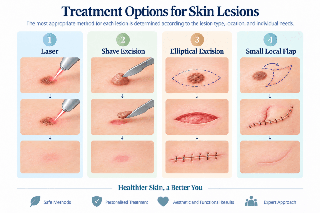 Treatment options for skin lesions including laser treatment, shave excision, elliptical excision and local flap reconstruction.